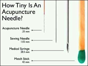 Acupuncture needle thickness diagram
